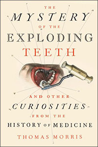 The Mystery of the Exploding Teeth